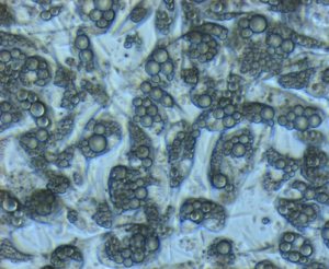 Mouse stromal vascular cells.pic